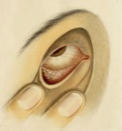 ophth